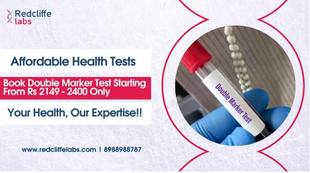 "Discover Top Ultrasound Services In Delhi At Bookmerilab"